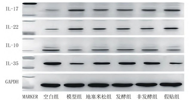 空白組和支氣管哮喘各組大鼠肺組織中IL－17、IL－22、IL－10、IL－35蛋白表達電泳圖